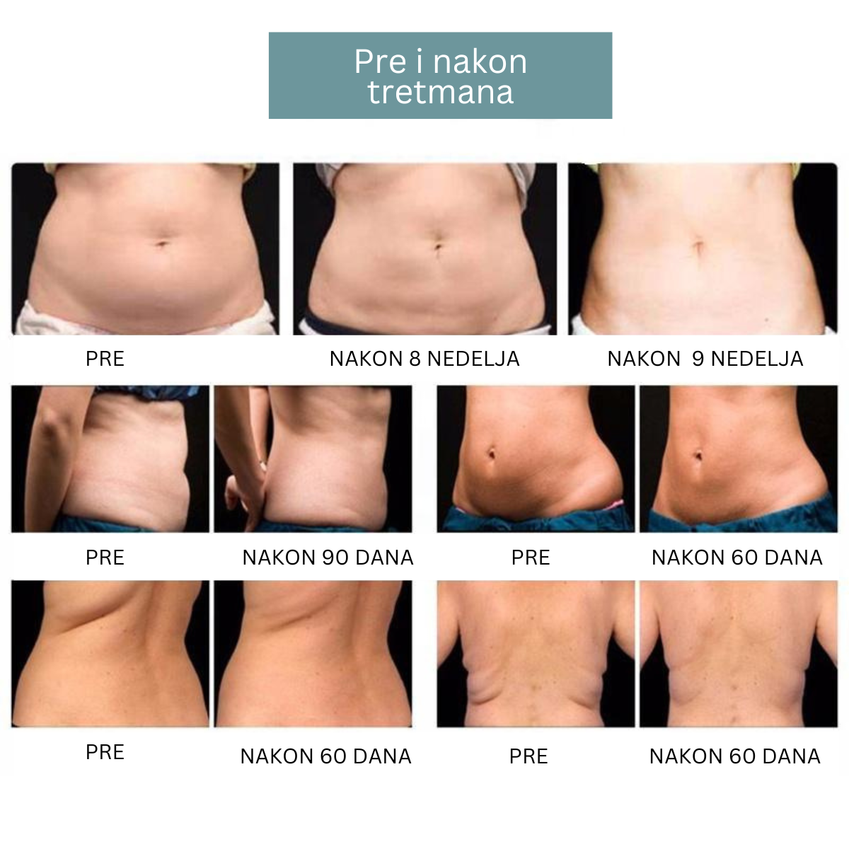 Multi Robot Facial & Body Treatment Machine – Cavitation, RF & Vacuum System